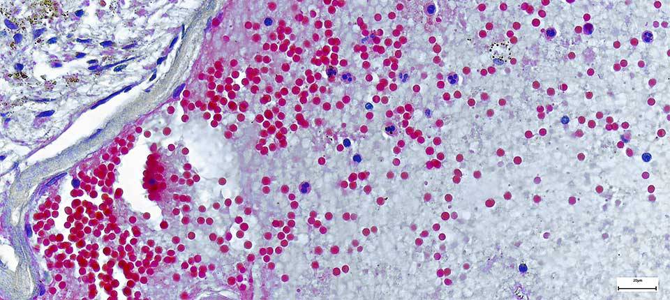 Monkeypox claims -Efficacy Testing